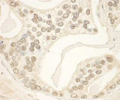 Immunohistochemistry: PHF23 Antibody [NBP1-28747]