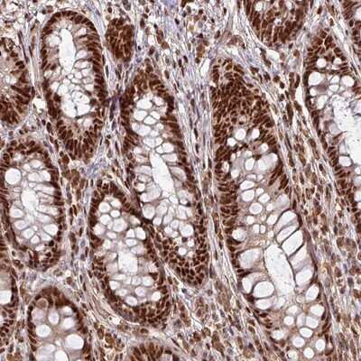Immunohistochemistry-Paraffin: PHF23 Antibody [NBP2-13756]