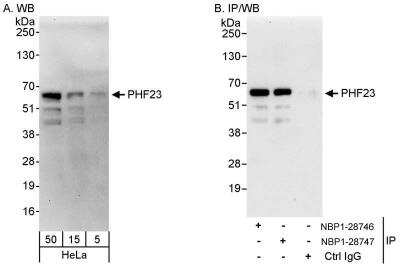 Western Blot: PHF23 Antibody [NBP1-28746]