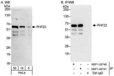 Western Blot: PHF23 Antibody [NBP1-28747]