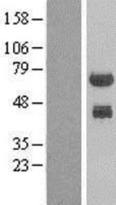 Western Blot: PHF23 Overexpression Lysate [NBL1-14359]