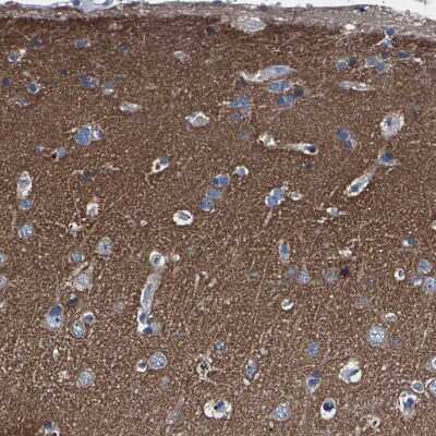 Immunohistochemistry-Paraffin: PHF24 Antibody [NBP1-90937]