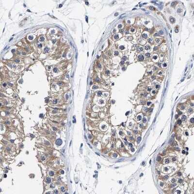 Immunohistochemistry-Paraffin: PHF24 Antibody [NBP1-90937]
