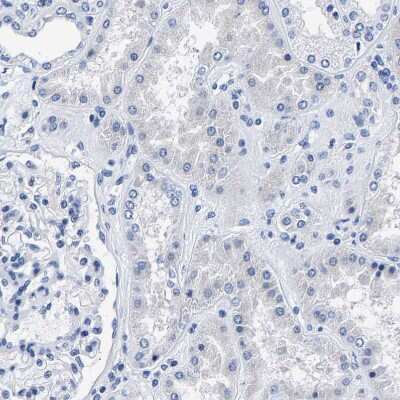 Immunohistochemistry-Paraffin: PHF24 Antibody [NBP1-90937]