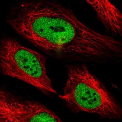 Immunocytochemistry/ Immunofluorescence: PHF3 Antibody [NBP1-86407]