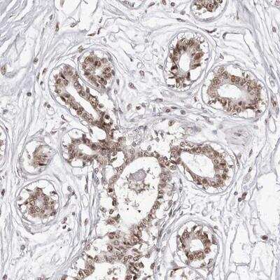 Immunohistochemistry-Paraffin: PHF3 Antibody [NBP1-86410]