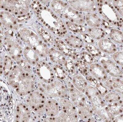 Immunohistochemistry-Paraffin: PHF5A Antibody [NBP1-88591]