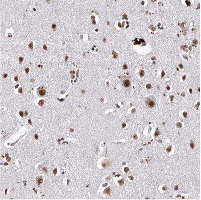Immunohistochemistry-Paraffin: PHF5A Antibody [NBP1-88591]