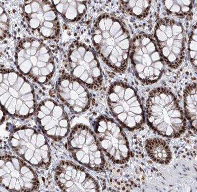 Immunohistochemistry-Paraffin: PHF5A Antibody [NBP1-88591]