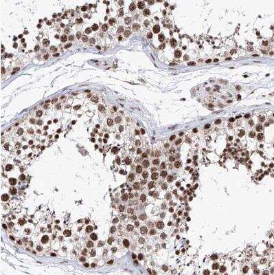 Immunohistochemistry-Paraffin: PHF5A Antibody [NBP1-88591]