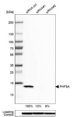 Western Blot: PHF5A Antibody [NBP1-88591]