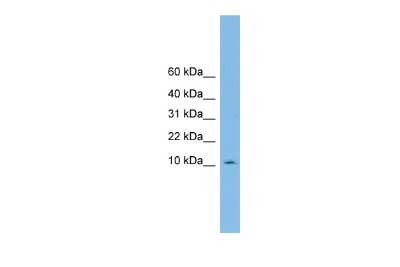 Western Blot: PHF5A Antibody [NBP2-83391]