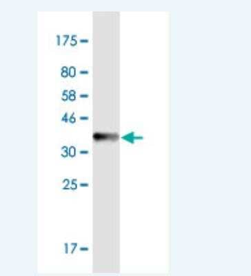 Western Blot: PHF6 Antibody (8F24) [H00084295-M01-100ug]