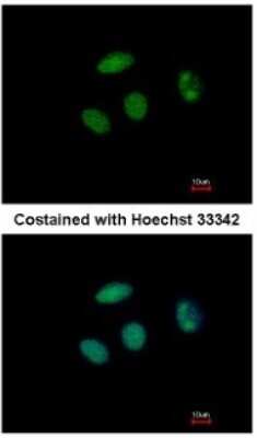 Immunocytochemistry/ Immunofluorescence: PHF6 Antibody [NBP2-19799]