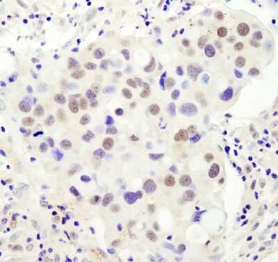 Immunohistochemistry-Paraffin: PHF6 Antibody [NB100-68261]