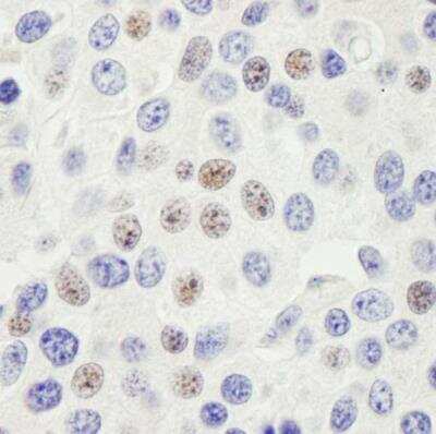Immunohistochemistry-Paraffin: PHF6 Antibody [NB100-68260]