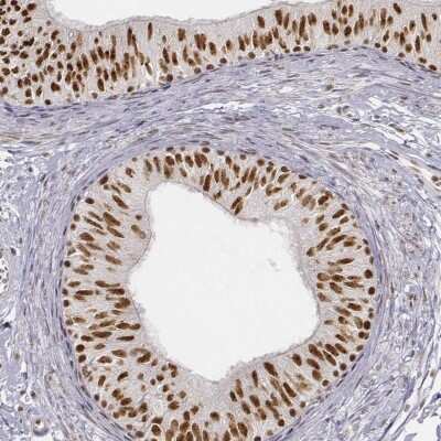 Immunohistochemistry-Paraffin: PHF6 Antibody [NBP1-88646]