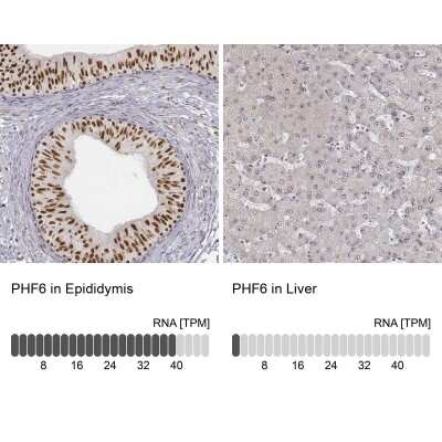 Immunohistochemistry-Paraffin: PHF6 Antibody [NBP1-88646]