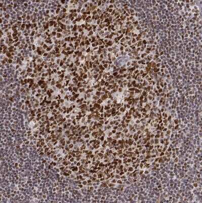 Immunohistochemistry-Paraffin: PHF6 Antibody [NBP1-88646]