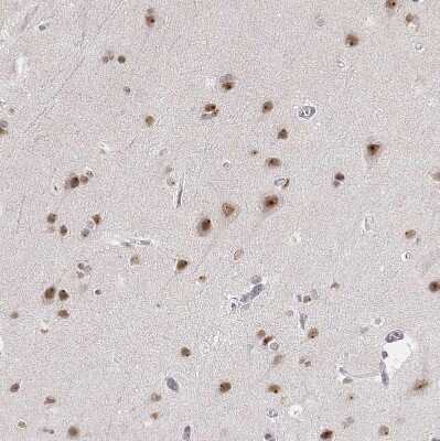 Immunohistochemistry-Paraffin: PHF6 Antibody [NBP1-88646]