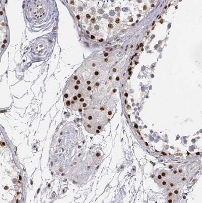 Immunohistochemistry-Paraffin: PHF6 Antibody [NBP1-88646]