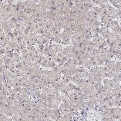 Immunohistochemistry-Paraffin: PHF6 Antibody [NBP1-88646]