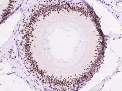 Immunohistochemistry-Paraffin: PHF6 Antibody [NBP2-97699]