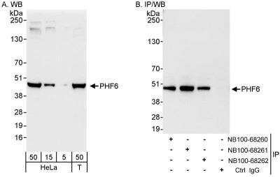 Western Blot: PHF6 Antibody [NB100-68260]