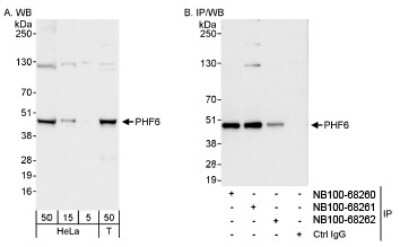 Western Blot: PHF6 Antibody [NB100-68261]