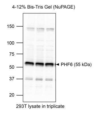 Western Blot: PHF6 Antibody [NB100-68262]