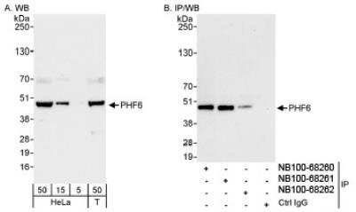 Western Blot: PHF6 Antibody [NB100-68262]