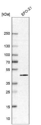 Western Blot: PHF6 Antibody [NBP1-88646]