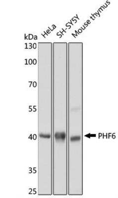 Western Blot: PHF6 Antibody [NBP2-95270]