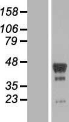 Western Blot: PHF6 Overexpression Lysate [NBP2-06017]