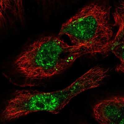 Immunocytochemistry/ Immunofluorescence: PHF7 Antibody [NBP2-49628]