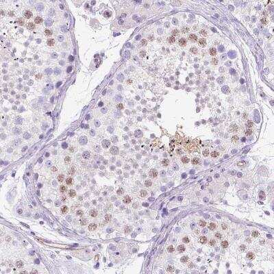 Immunohistochemistry-Paraffin: PHF7 Antibody [NBP1-81674]
