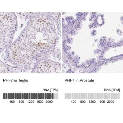 Immunohistochemistry-Paraffin: PHF7 Antibody [NBP1-81674]