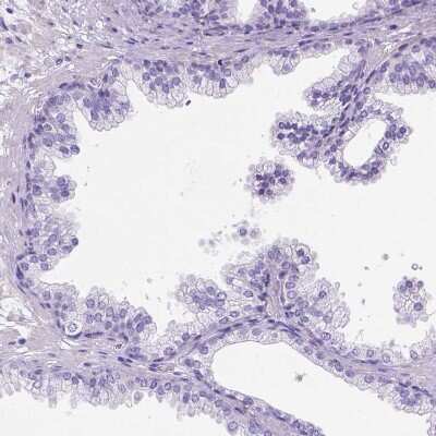 Immunohistochemistry-Paraffin: PHF7 Antibody [NBP1-81674]