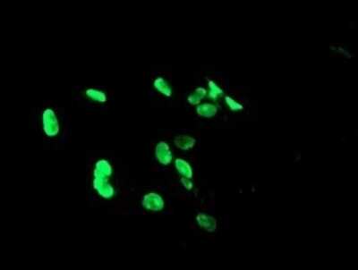 Immunofluorescence: PHF7 Antibody (OTI1G9) [NBP2-45881]