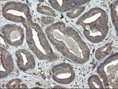 Immunohistochemistry: PHF7 Antibody (OTI1G9) [NBP2-45881]