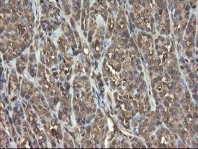 Immunohistochemistry: PHF7 Antibody (OTI1G9) [NBP2-45881]