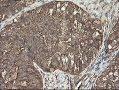 Immunohistochemistry: PHF7 Antibody (OTI1G9) [NBP2-45881]