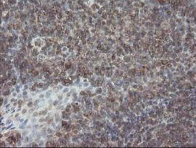 Immunohistochemistry: PHF7 Antibody (OTI1G9) [NBP2-45881]