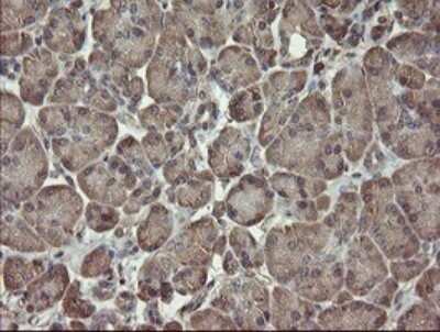 Immunohistochemistry: PHF7 Antibody (OTI1G9) [NBP2-45881]