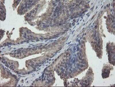 Immunohistochemistry: PHF7 Antibody (OTI1G9) [NBP2-45881]