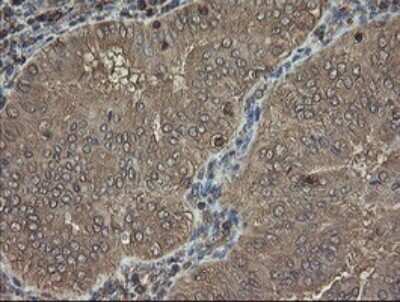 Immunohistochemistry: PHF7 Antibody (OTI1G9) [NBP2-45881]