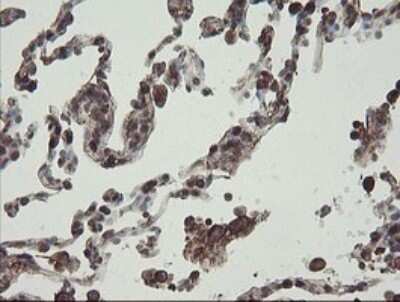 Immunohistochemistry: PHF7 Antibody (OTI1G9) [NBP2-45881]