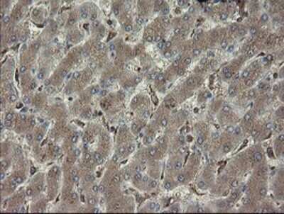 Immunohistochemistry: PHF7 Antibody (OTI1G9) [NBP2-45881]