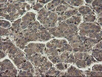 Immunohistochemistry: PHF7 Antibody (OTI1G9) [NBP2-45881]