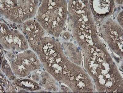 Immunohistochemistry: PHF7 Antibody (OTI1G9) [NBP2-45881]